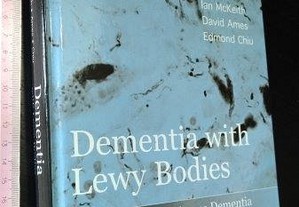 Dementia with lewy bodies and parkinson's disease dementia - John O'Brien