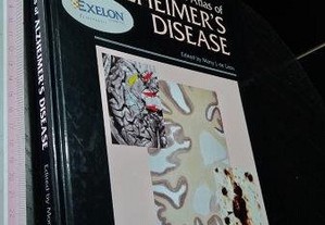 An atlas of alzheimer's disease - Mony J. de Leon