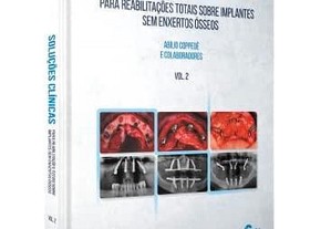 Solues Clnicas Para Reabilitaes Totais Sobre Implantes Sem Enxertos sseos - Vol. 2